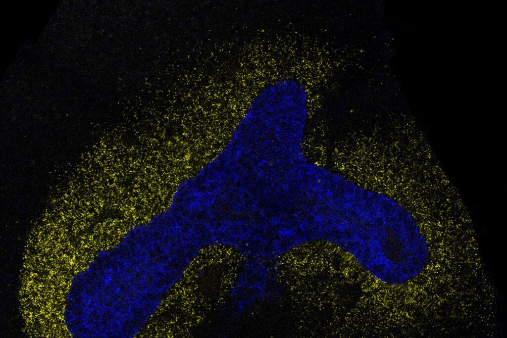 AI model decodes the language cells use to communicate | MIT News